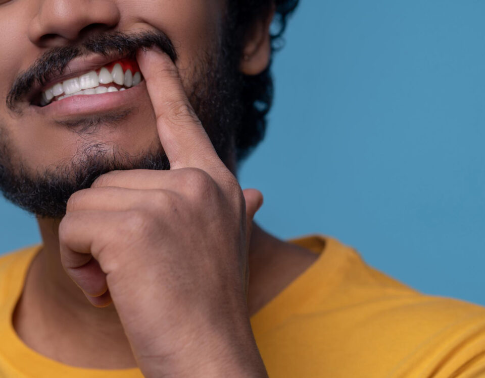 Periodontia: quando o sangramento preocupa de verdade
